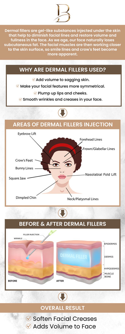 Dermal fillers are a non-surgical solution to restore volume, smooth wrinkles, and enhance facial contours. This treatment helps reduce the appearance of fine lines, plump hollow areas, and creates a more youthful, refreshed look. Dr. Marlin, MD, and Dr. Ngu Thien Nguyen, MD, offer a quick and effective way to rejuvenate your appearance without the need for surgery. For more information, contact us or request an appointment online. We are located at 1507 NE 150th St, Suite B, Shoreline, WA 98155. Dermal fillers are a non-surgical solution to restore volume, smooth wrinkles, and enhance facial contours. This treatment helps reduce the appearance of fine lines, plump hollow areas, and creates a more youthful, refreshed look. Dr. Marlin, MD, and Dr. Ngu Thien Nguyen, MD, offer a quick and effective way to rejuvenate your appearance without the need for surgery. For more information, contact us or request an appointment online. We are located at 1507 NE 150th St, Suite B, Shoreline, WA 98155.
