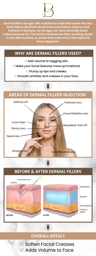 Dermal fillers are a non-surgical solution to restore volume, smooth wrinkles, and enhance facial contours. This treatment helps reduce the appearance of fine lines, plump hollow areas, and creates a more youthful, refreshed look. Dr. Marlin, MD, and Dr. Ngu Thien Nguyen, MD, offer a quick and effective way to rejuvenate your appearance without the need for surgery. For more information, contact us or request an appointment online. We are located at 1507 NE 150th St, Suite B, Shoreline, WA 98155.
