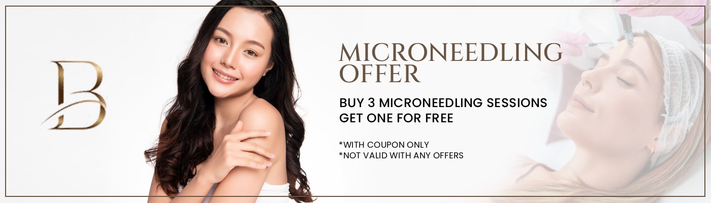 Buy 3 Microneedling Sessions, Get one for Free in Shoreline, WA Buy 3 Microneedling Sessions, Get one for Free in Shoreline, WA